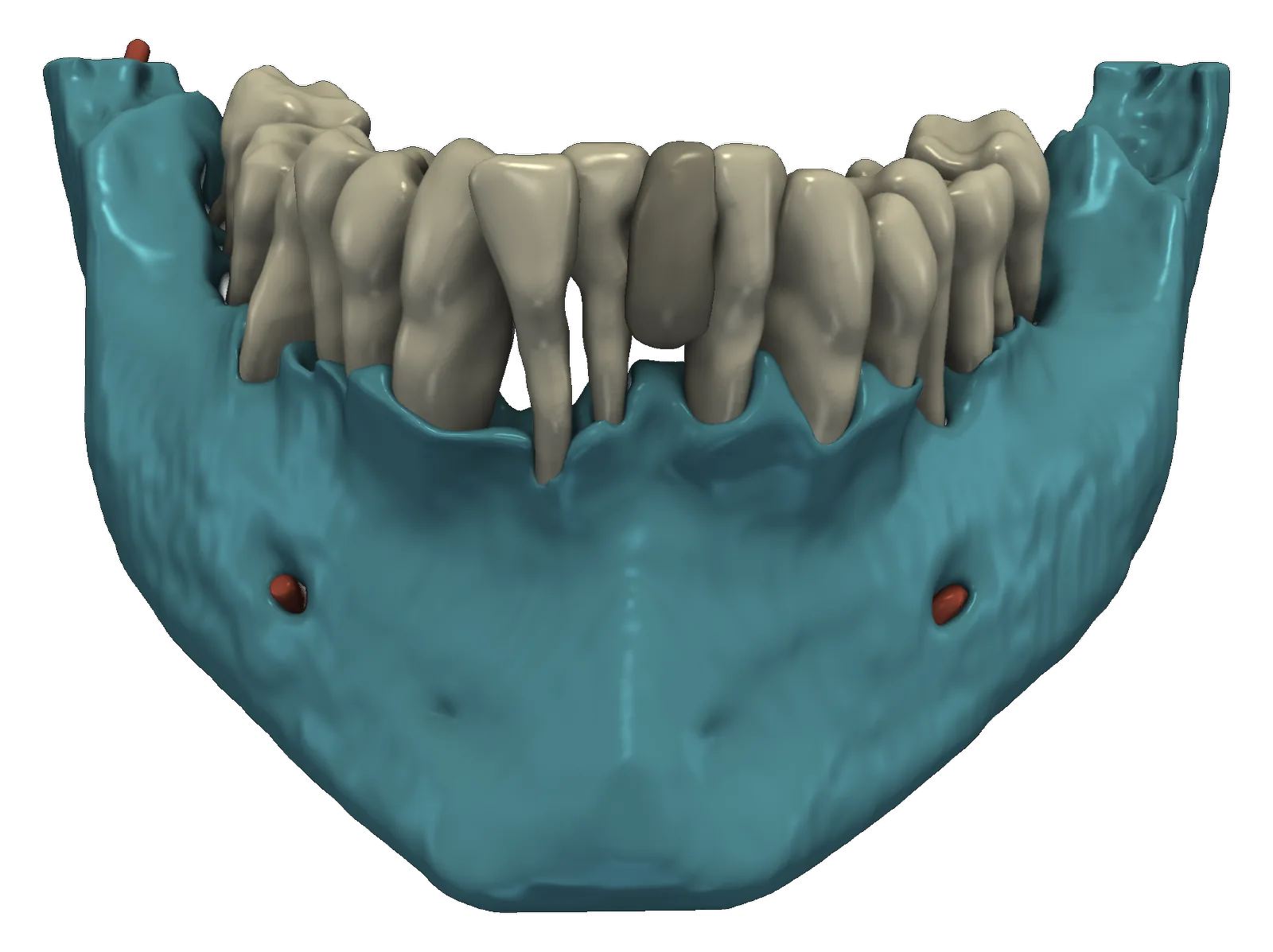 Dent.AI segmentation of the same scan: mandible, individual teeth and nerve canal as separate structures.